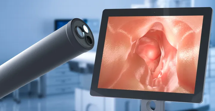 Colonoscopy procedure